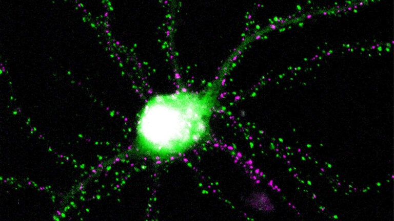 Genetically engineered proteins glow within a neuron.